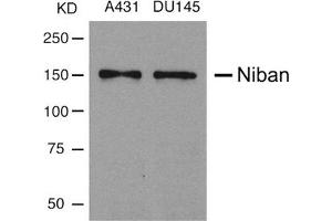Western blot analysis of extracts from A431 and DU145 cells using Niban Antibody. (Niban antibody)