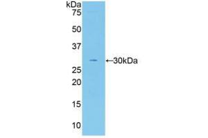 Western blot analysis of recombinant Human F5. (Coagulation Factor V antibody  (AA 1979-2217))