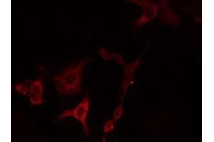 ABIN6274724 staining HeLa cells by IF/ICC. (HSD3B7 antibody  (Internal Region))