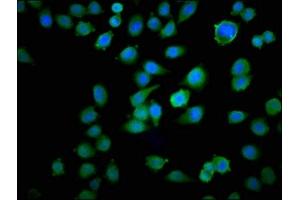 Immunofluorescence staining of Hela cells with ABIN7172906 at 1:100, counter-stained with DAPI. (TPT1 antibody  (AA 1-172))