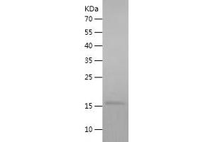 Western Blotting (WB) image for Interferon gamma (IFNG) (AA 24-174) protein (His tag) (ABIN7123485)
