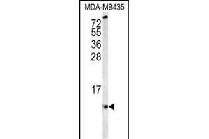 Western blot analysis of COX6A1 Antibody (Center) (ABIN653100 and ABIN2842691) in MDA-M cell line lysates (35 μg/lane). (COX6A1 antibody  (AA 50-78))