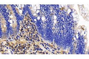Immunohistochemistry (IHC) image for anti-BCL2-Like 11 (Apoptosis Facilitator) (BCL2L11) (AA 2-120) antibody (ABIN7430234)
