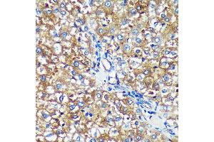 Immunohistochemistry of paraffin-embedded Rat liver using PYCR2 Rabbit pAb (ABIN7269766) at dilution of 1:100 (40x lens). (PYCR2 antibody  (AA 271-320))