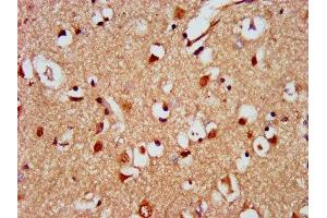IHC image of ABIN7150918 diluted at 1:500 and staining in paraffin-embedded human brain tissue performed on a Leica BondTM system. (KIAA0319 antibody  (AA 153-268))
