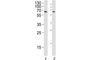 Western Blotting (WB) image for anti-YY1 Transcription Factor (YY1) antibody (ABIN3029666)
