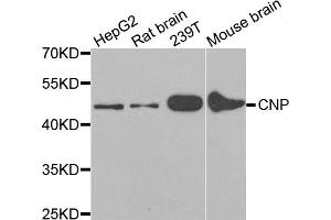 Western blot analysis of extracts of various cell lines, using CNP antibody. (Cnpase antibody)