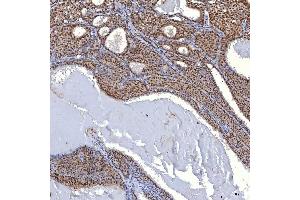 IHC analysis of TRMT61A using anti-TRMT61A antibody (ABIN7599220). (TRMT61A antibody  (AA 1-289))