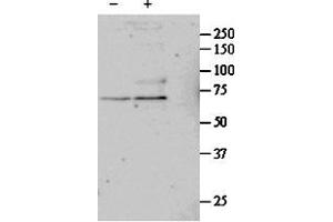 ABIN571032 (1µg/ml) staining of untreated (first lane) and TGF-bl-treated (second lane) primary cultured Human Lung fibroblast lysate. (SRF antibody  (Internal Region))