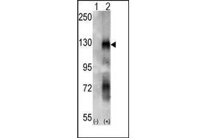 Western blot analysis of EphA6 (arrow) using rabbit polyclonal EphA6 Antibody. (EPH Receptor A6 antibody)