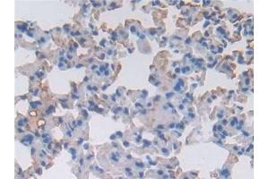 Detection of a1ACT in Mouse Lung Tissue using Polyclonal Antibody to Alpha-1-Antichymotrypsin (a1ACT) (a1-Antichymotrypsin (AA 23-253) antibody)