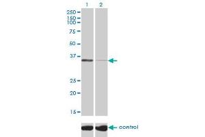 Western blot analysis of TSTA3 over-expressed 293 cell line, cotransfected with TSTA3 Validated Chimera RNAi (Lane 2) or non-transfected control (Lane 1). (TSTA3 antibody  (AA 222-321))