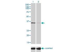 Western blot analysis of TSTA3 over-expressed 293 cell line, cotransfected with TSTA3 Validated Chimera RNAi (Lane 2) or non-transfected control (Lane 1).