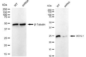 Western blotting analysis using UCHL1 antibody (ABIN7800708).