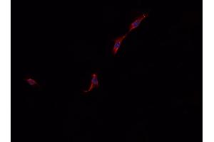 ABIN6268931 staining A549 cells by IF/ICC. (SQSTM1 antibody  (C-Term))