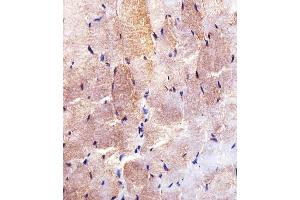 Immunohistochemical analysis of paraffin-embedded H. (Hexokinase 2 antibody  (AA 453-483))