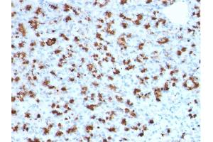 Formalin-fixed, paraffin-embedded human Pancreas stained with BARX1 Mouse Monoclonal Antibody (BARX1/2760). (BARX1 antibody)