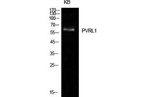 Western Blot (WB) analysis of KB cells using Nectin 1 Polyclonal Antibody. (PVRL1 antibody  (Internal Region))
