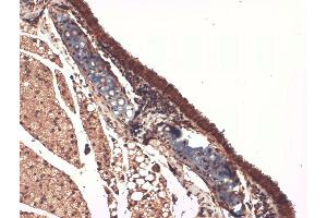 Immunohistochemistry analysis using Mouse Anti-Sodium Iodide Symporter Monoclonal Antibody, Clone 14F . (SLC5A5 antibody  (AA 468-643) (Atto 594))