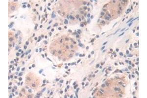 Immunohistochemistry (IHC) image for anti-Interferon, gamma-Inducible Protein 30 (IFI30) (AA 1-250) antibody (ABIN7435856)