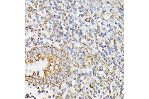 Immunohistochemistry of paraffin-embedded human appendix using RHOG antibody (ABIN7269864) at dilution of 1:100 (40x lens). (RHOG antibody)