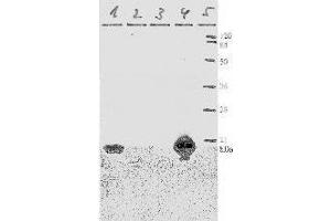 Western Blotting (WB) image for anti-Human Papilloma Virus 11 E7 (HPV-11 E7) (AA 36-70) antibody (ABIN781777) (Human Papilloma Virus 11 E7 (HPV-11 E7) (AA 36-70) antibody)