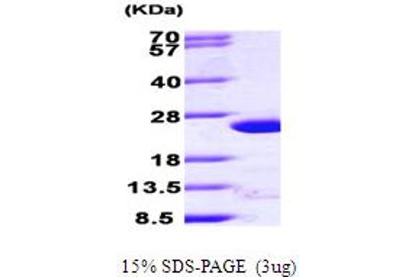 ARF4 Protein (AA 1-180) (His tag)