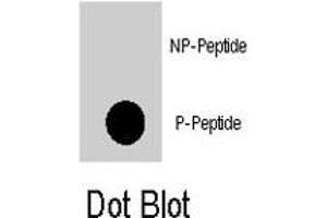 Dot blot analysis of PDPK1 (phospho S396) polyclonal antibody  on nitrocellulose membrane. (PDPK1 antibody  (pSer396))