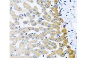 Immunohistochemistry of paraffin-embedded Human liver damage using M6PR Polyclonal Antibody at dilution of 1:100 (40x lens). (M6PR antibody)