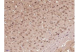 Immunohistochemistry (Paraffin-embedded Sections) (IHC (p)) image for anti-Zinc Finger Protein GLI1 (GLI1) (AA 601-700) antibody (ABIN673374)