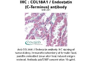 Image no. 1 for anti-Collagen, Type XVIII, alpha 1 (COL18A1) antibody (ABIN1733192) (COL18A1 antibody)