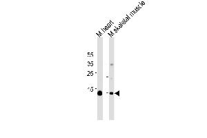 Myoglobin Antibody (ABIN1539881 and ABIN2843846) western blot analysis in mouse heart and skeletal muscle tissue lysates (35 μg/lane). (Myoglobin antibody  (AA 103-130))