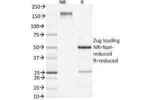 SDS-PAGE Analysis Purified IL-4 Rat Monoclonal Antibody (11B11).