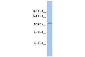 WB Suggested Anti-DDX24  Antibody Titration: 0. (DDX24 antibody  (Middle Region))