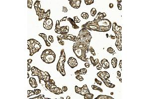 IHC analysis of COL4A3 using anti-COL4A3 antibody (ABIN7600055).