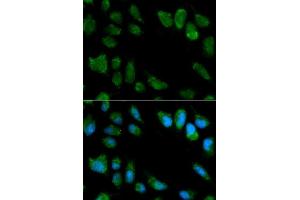 Immunofluorescence analysis of MCF-7 cells using IL1RN antibody.