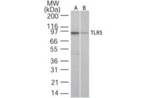 Image no. 2 for anti-Toll-Like Receptor 5 (TLR5) (AA 700-800) antibody (ABIN208231) (TLR5 antibody  (AA 700-800))