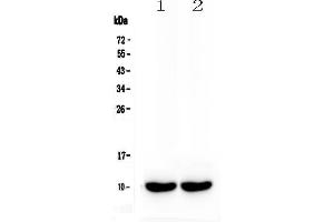 Western blot analysis of Uteroglobin using anti-Uteroglobin antibody .