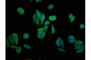 Immunofluorescence staining of HepG2 cells with ABIN7148935 at 1:133, counter-stained with DAPI. (GAK antibody  (AA 939-1086))