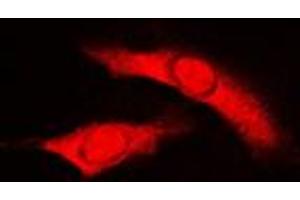 Immunofluorescent analysis of RAD23B staining in HuvEc cells. (RAD23B antibody  (N-Term))