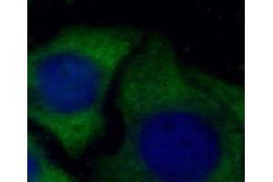 IF analysis of HepG2 cells, using ORM2 antibody (1/100 dilution) and AF488-conjugated Goat anti-Mouse IgG (H+L) antibody. (Orosomucoid 2 antibody)