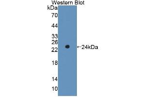 Western blot analysis of the recombinant protein. (RIPK1 antibody  (AA 1-179))