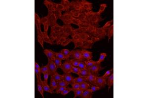 Immunofluorescence analysis of C2C12 cells using GLUT4 antibody (ABIN6134112, ABIN6147963, ABIN6147964 and ABIN6223551) at dilution of 1:100 (40x lens). (GLUT4 antibody  (C-Term))
