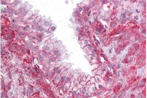 Immunohistochemistry with Prostate tissue at an antibody concentration of 5µg/ml using anti-TMTC4 antibody (ARP45026_P050) (TMTC4 antibody  (N-Term))