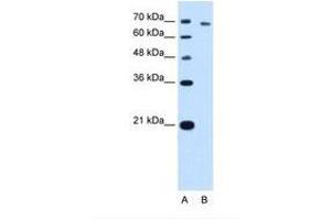 Image no. 2 for anti-threonyl-tRNA Synthetase (TARS) (AA 51-100) antibody (ABIN341310) (TARS antibody  (AA 51-100))