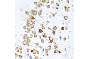 Immunohistochemistry of paraffin-embedded rat brain using EL antibody (ABIN6134651, ABIN6140118, ABIN6140119 and ABIN6221704) at dilution of 1:200 (40x lens). (HuC/ELAVL3 antibody  (AA 1-100))