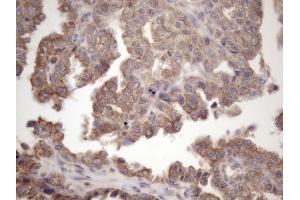 Immunohistochemistry (IHC) image for anti-Amelotin (AMTN) antibody (ABIN2716038)