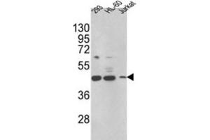 Western Blotting (WB) image for anti-Hydroxysteroid (17-Beta) Dehydrogenase 7 (HSD17B7) antibody (ABIN3002789) (HSD17B7 antibody)