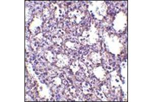 Immunohistochemistry of STIM2 in human spleen tissue with this product at 2. (Stim2 antibody  (Center))