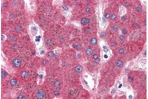 Human Liver (formalin-fixed, paraffin-embedded) stained with SERPINF2 antibody ABIN351490 at 3. (alpha 2 Antiplasmin antibody  (AA 454-468))